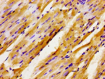 GTF3 / GTF2IRD1 Antibody