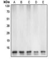 Polyclonal Rabbit anti-Human CASP7 / Caspase 7 Antibody (Internal, IHC, WB)