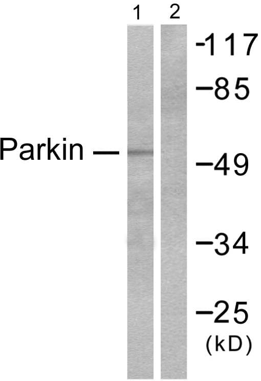Polyclonal Rabbit anti-Human PARK2 / Parkin 2 Antibody (IHC, WB)