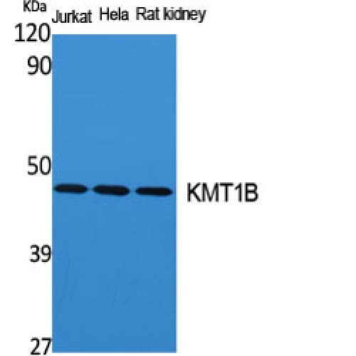 Polyclonal Rabbit anti-Human SUV39H2 Antibody (80-160 aa, Internal, WB)