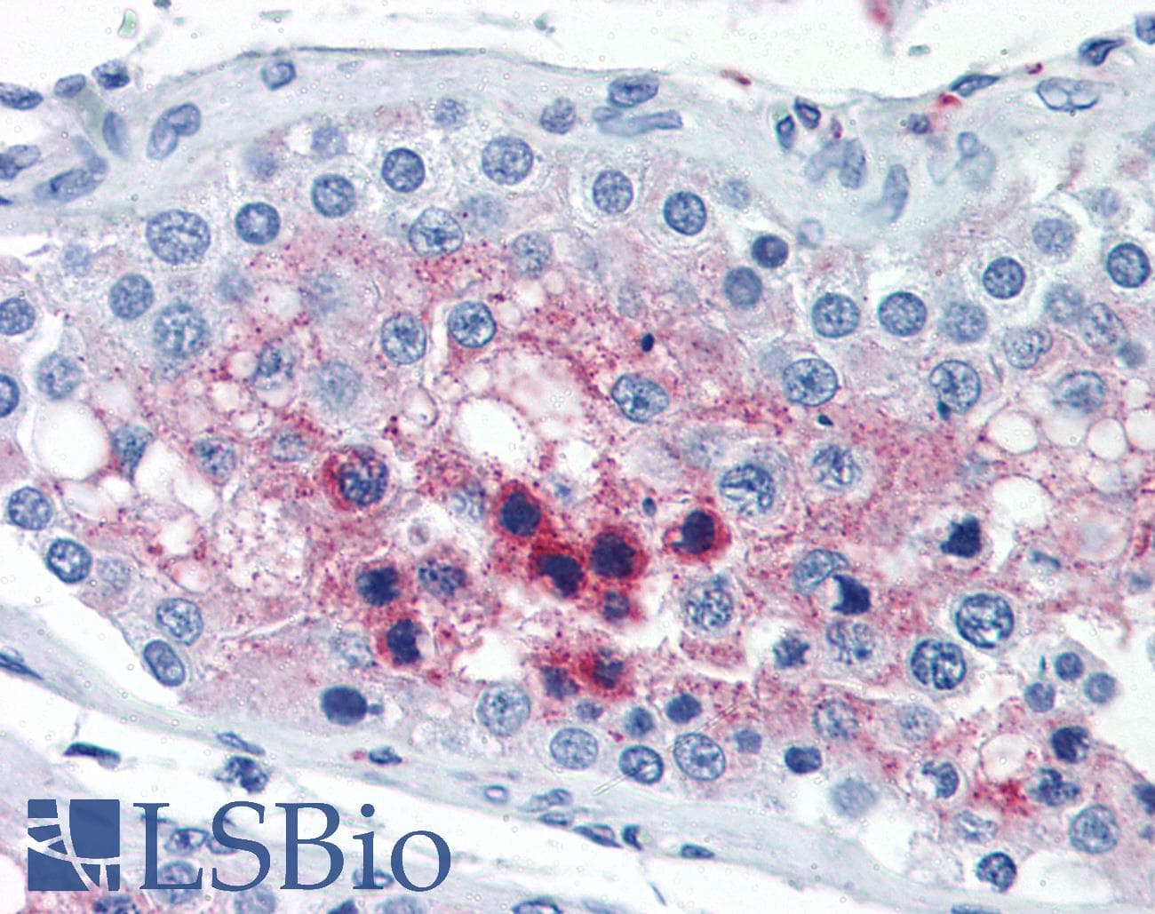 PathPlus™ Monoclonal Mouse anti-Human CTSV / Cathepsin V Antibody (clone BV55-1, IHC, WB)