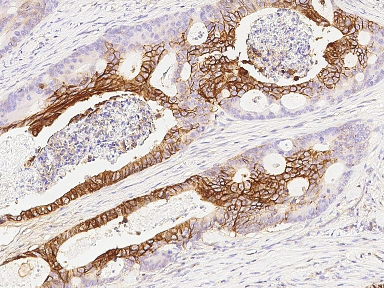 NDRG1 Antibody (Preservative Free)