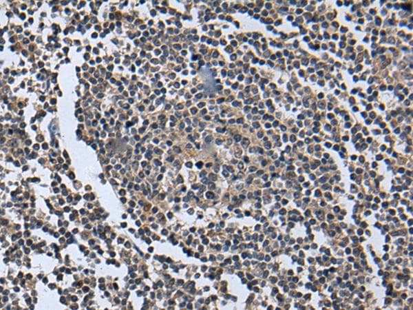WNT9B / WNT15 Antibody