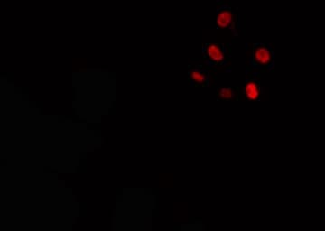 Polyclonal Rabbit anti-Human CKS1B / CKS1 Antibody (IF, WB)