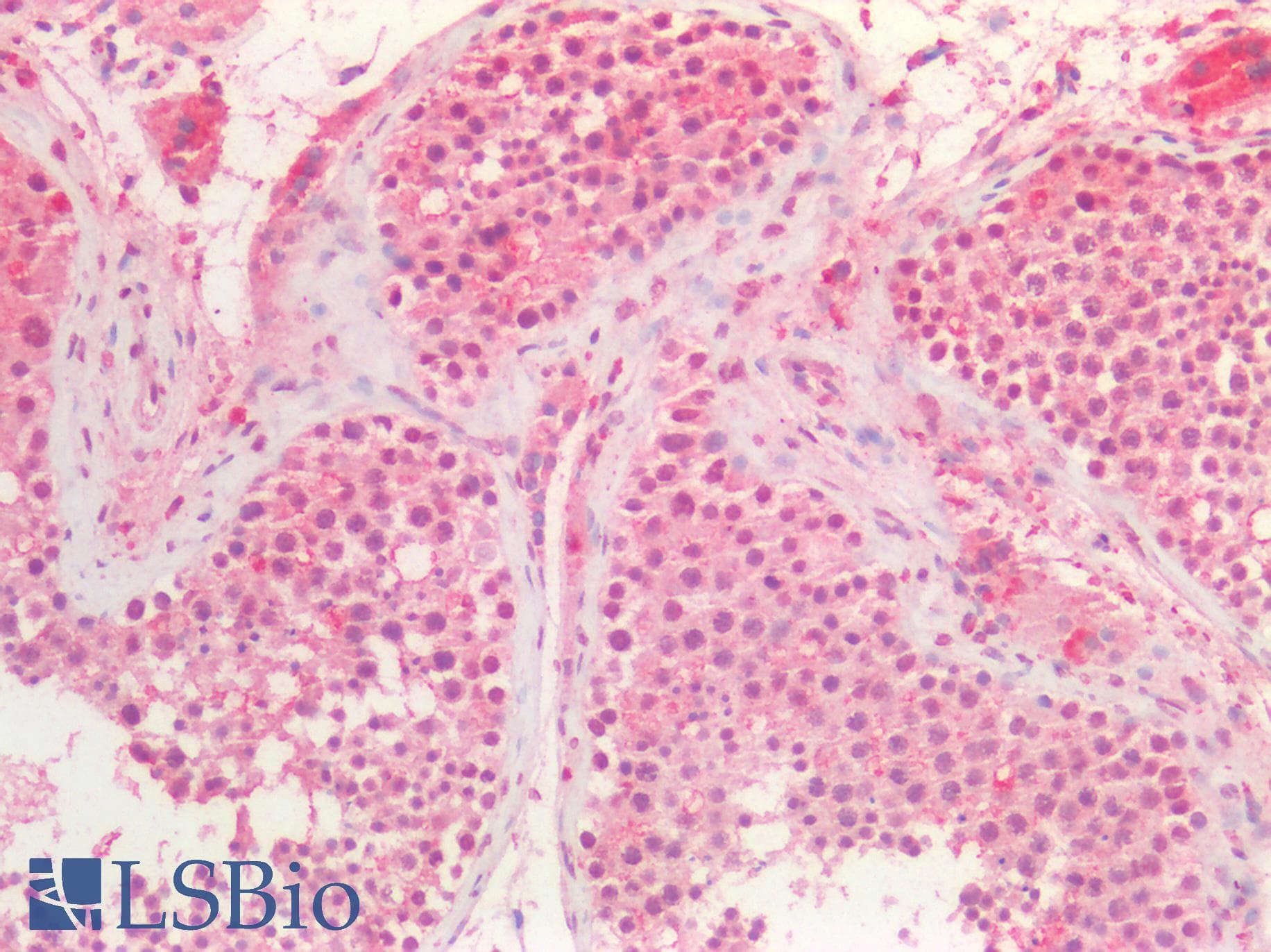 IHC-plus™ Polyclonal Goat anti-Human BMI1 / PCGF4 Antibody (aa237-251, IHC, WB)