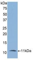 IL6R / IL6 Receptor Antibody (aa385-462)