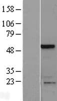 SLAIN1 Protein (Over-Expression Lysate Myc-DDK (Flag))
