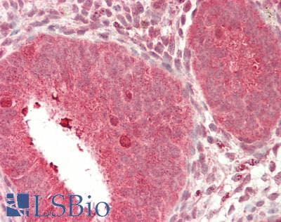 KMO Antibody (aa135-184)