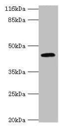 Polyclonal Rabbit anti-Human USP12 Antibody (IHC, WB)