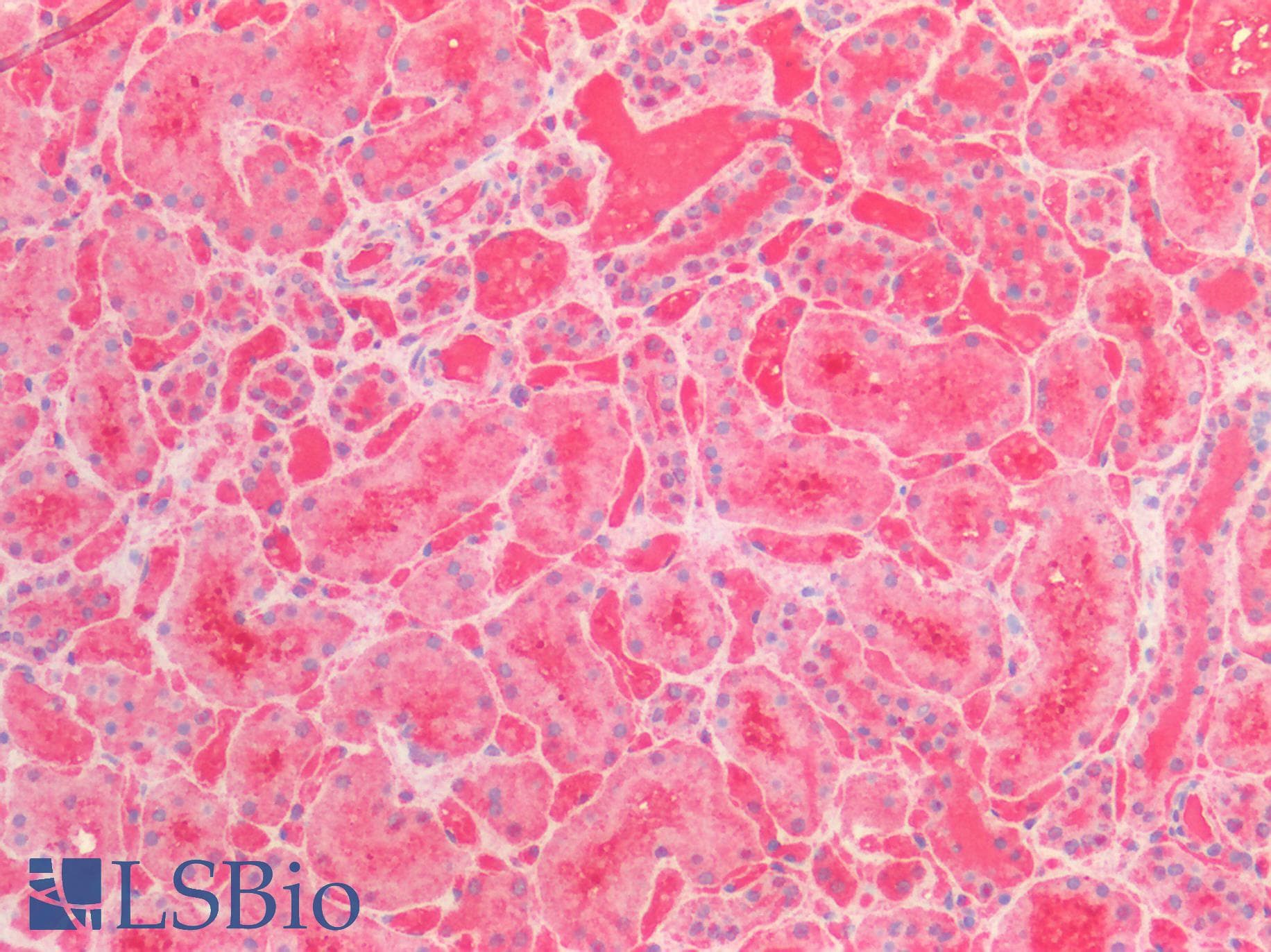 PathPlus™ Polyclonal Rabbit anti-Human ENO1 / Alpha Enolase Antibody (IHC, WB)