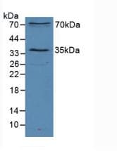 SIRT2 / Sirtuin 2 Antibody (aa65-340)