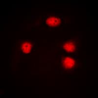 IHC-plus™ Polyclonal Rabbit anti-Human ZIC1+2+3 Antibody (Internal, IHC, IF, WB)