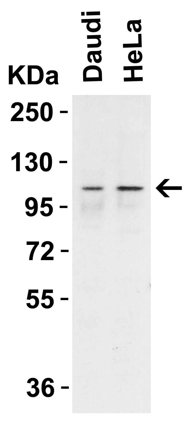 IHC-plus™ IFIH1 / MDA5 Antibody