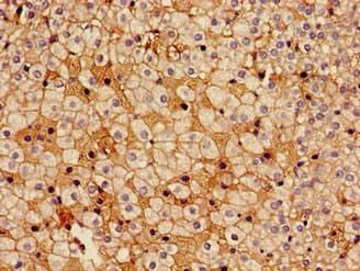 HSD17B7 / PRAP Antibody