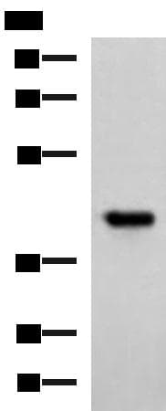 FCRLA Antibody