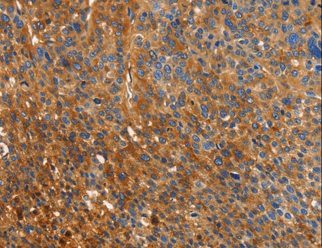 IHC-plus™ ORM2 / Orosomucoid 2 Antibody