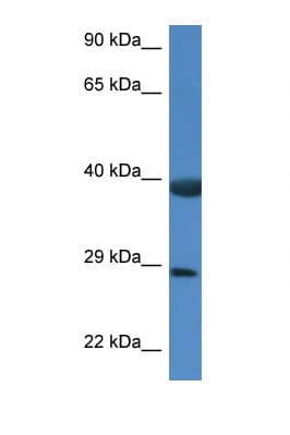 HSPBP1 Antibody (aa226-275)