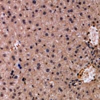 PNLIP / PL / Pancreatic Lipase Antibody