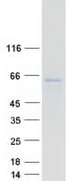Human PPAT Protein (Recombinant Myc-DDK (Flag))