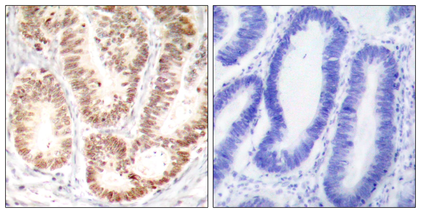 MAPK14 / p38 Antibody (phospho-Tyr182)