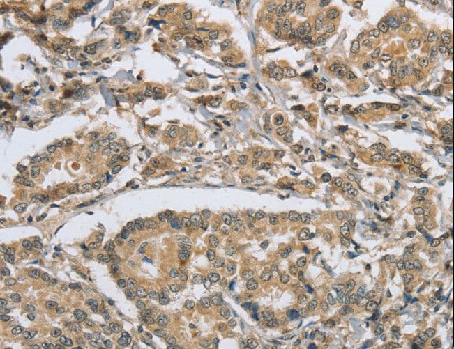 IHC-plus™ PKD1 / Polycystin Antibody (aa3725-3735)