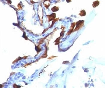 Monoclonal Mouse anti-Human Cytokeratin 8+18 Antibody (clone C-51, Ready-to-Use, IHC, IF, WB)