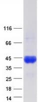 Human C4BPB / C4BP Beta Protein (Recombinant Myc-DDK (Flag))