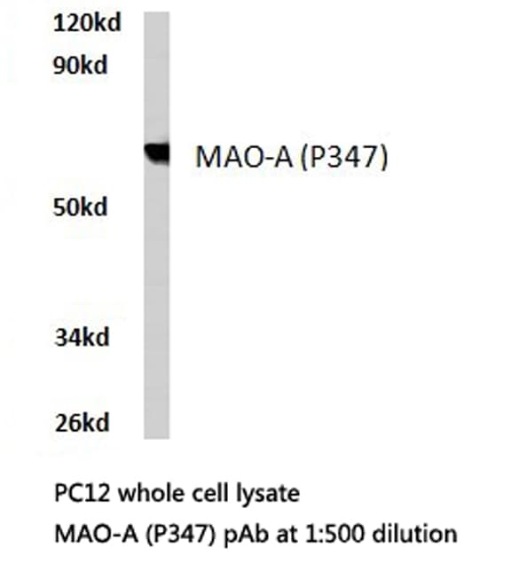 Polyclonal Rabbit anti-Human MAOA / Monoamine Oxidase Antibody (Pro347, IHC, WB)