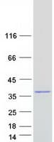 Human NEBL LASP2 Protein (Recombinant Myc-DDK (Flag))