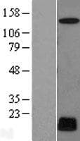 (CYREN) C7orf49 Protein (Over-Expression Lysate Myc-DDK (Flag))