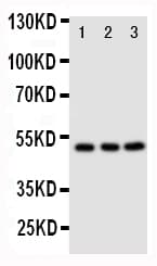 CXCR4 Antibody (aa31-43)