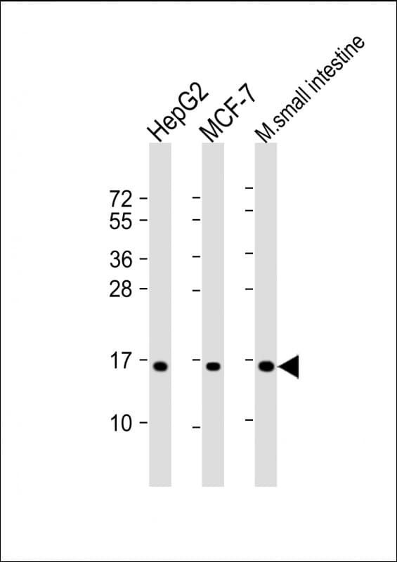 Polyclonal Rabbit anti-Human COX4I2 Antibody (WB)