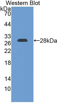 GAS6 Antibody (aa100-312)