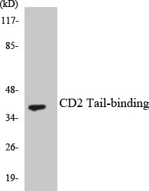 Polyclonal Rabbit anti-Human CD2BP2 Antibody (aa75-124, WB)