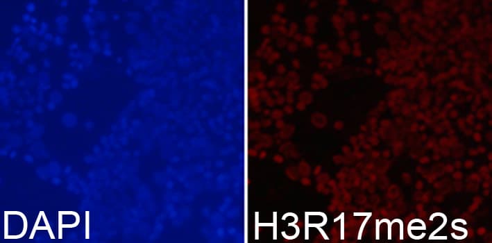 Histone H3 Antibody (Sym-Di-Methyl-Arg17)