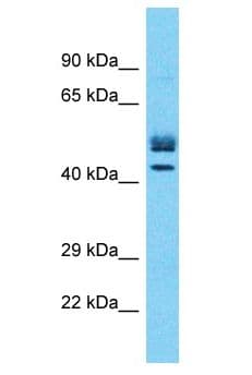 MTA1 Antibody (aa174-223)