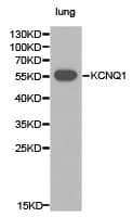 Polyclonal Rabbit anti-Human KCNQ1 / KVLQT1 Antibody (IHC, WB)