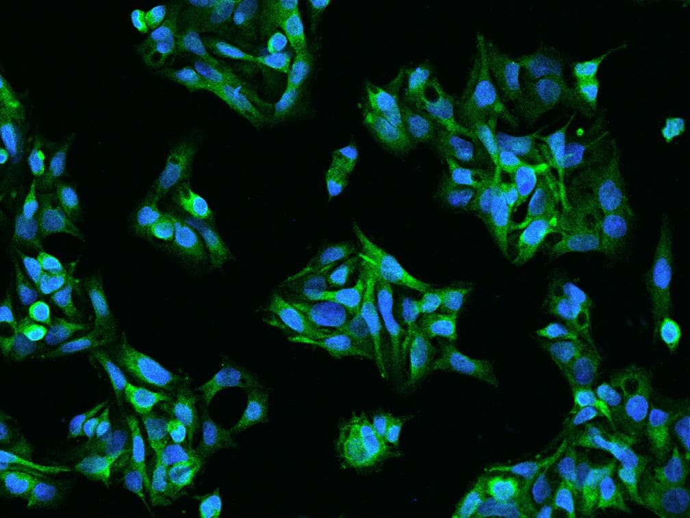 ATRN / Attractin Antibody