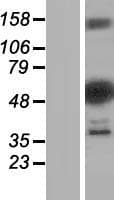 DENND2D Protein (Over-Expression Lysate Myc-DDK (Flag))
