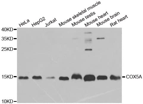 Polyclonal Rabbit anti-Human COX5A Antibody (IHC, IF, WB)