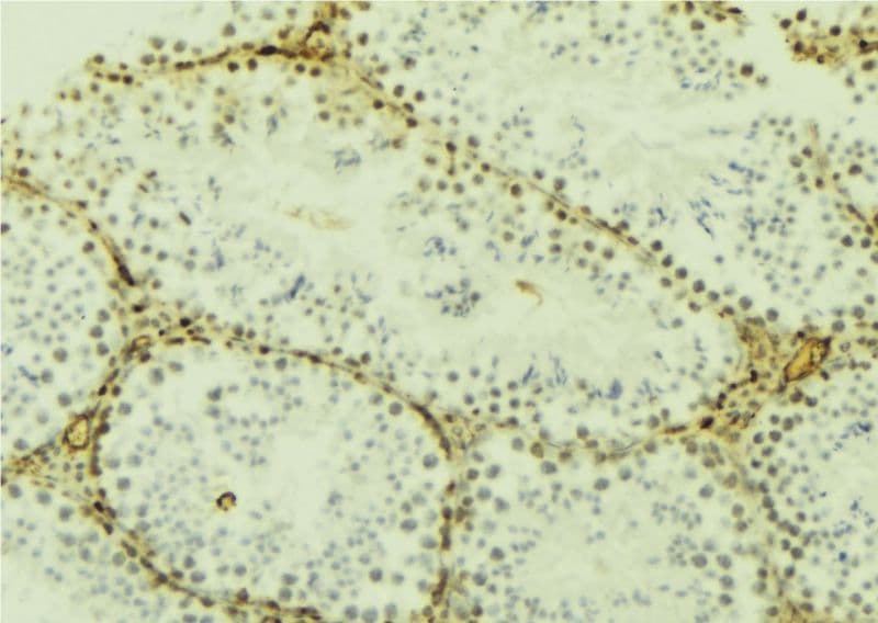 DNMT3L Antibody