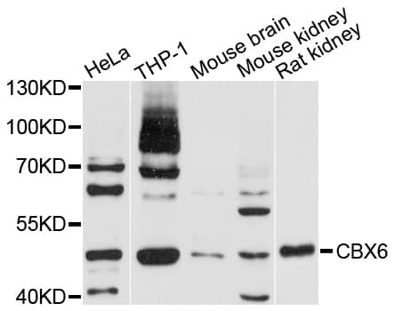 Polyclonal Rabbit anti-Human CBX6 Antibody (WB)