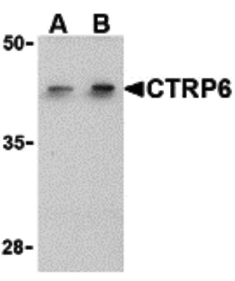IHC-plus™ C1QTNF6 / CTRP6 Antibody