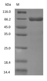 ALB / Serum Albumin Protein (Native)