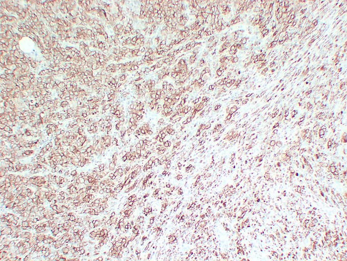 Monoclonal Mouse anti-Human Tyrosinase Antibody (clone ABT-TYR, IHC)