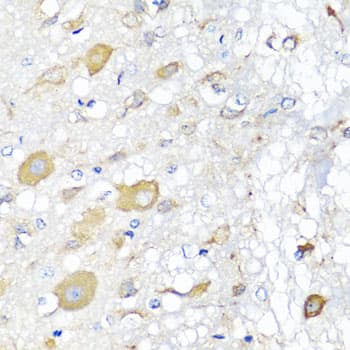 CALHM1 Antibody