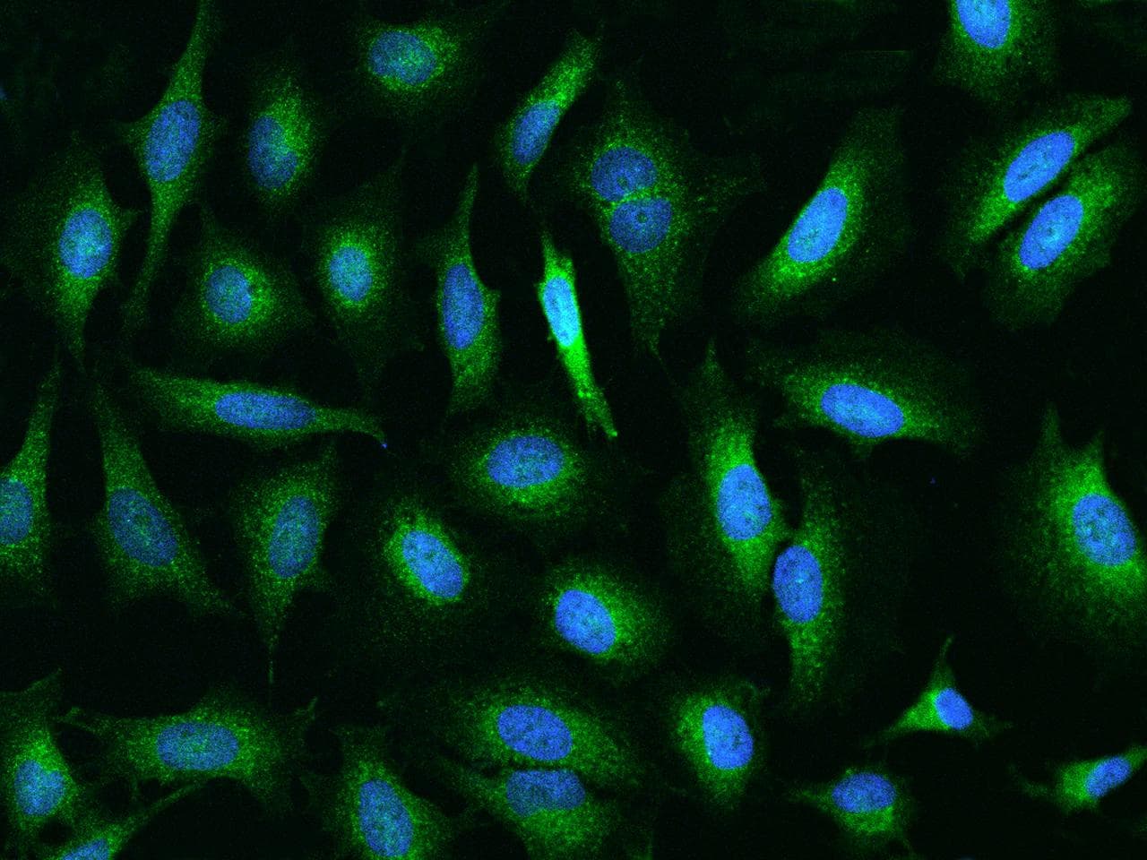 Polyclonal Rabbit anti-Human UCP1 / UCP-1 Antibody (Preservative Free, IF)