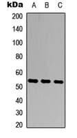 IHC-plus™ Polyclonal Rabbit anti-Human MMP20 Antibody (Internal, IHC, WB)