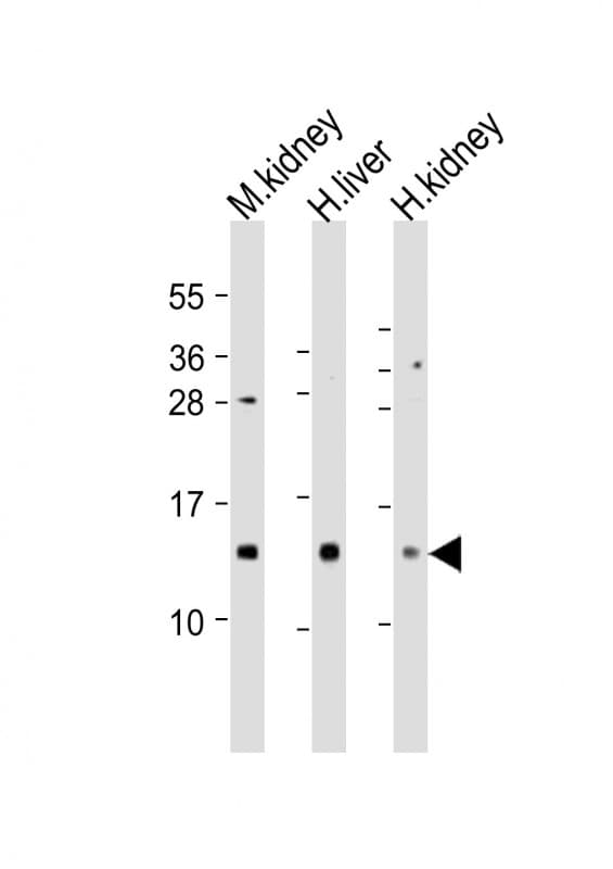 Polyclonal Rabbit anti-Human MTCP1 Antibody (aa73-103, WB)