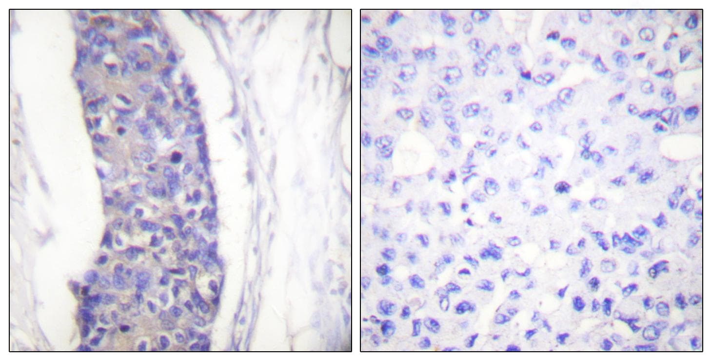Polyclonal Rabbit anti-Human Alpha Tubulin Antibody (IHC, IF, WB)